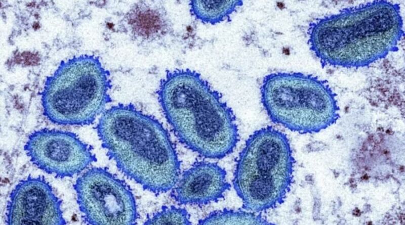 Confirmado o primeiro caso de Varíola dos macacos no Brasil